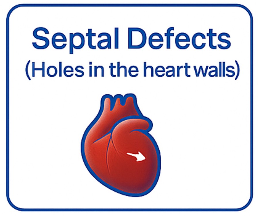 Septal Defects
